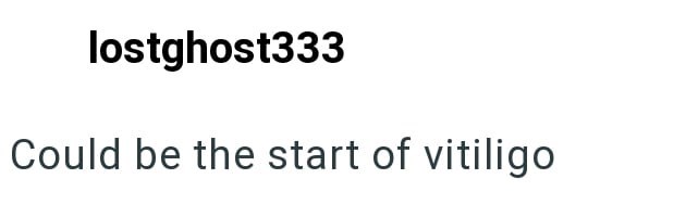 lostghost333 Could be the start of vitiligo