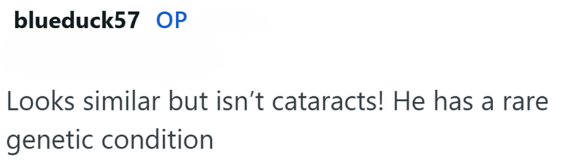 blueduck57 OP Looks similar but isn't cataracts! He has a rare genetic condition