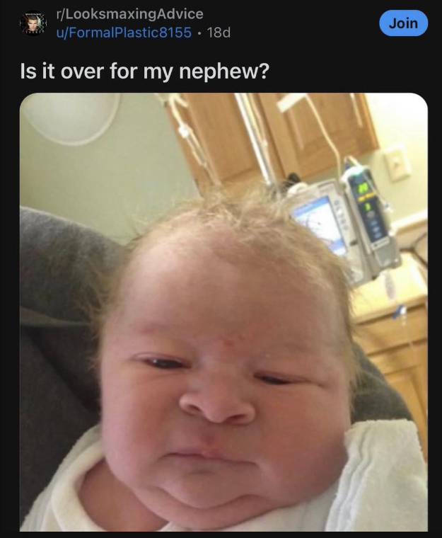 r/LooksmaxingAdvice u/FormalPlastic8155. 18d Is it over for my nephew? Join