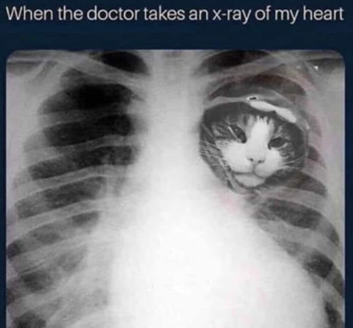 When the doctor takes an x-ray of my heart