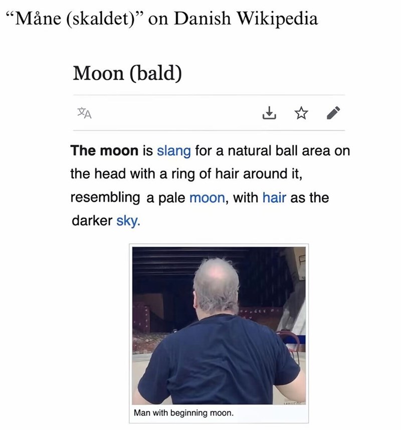 "Måne (skaldet)" on Danish Wikipedia Moon (bald) The moon is slang for a natural ball area on the head with a ring of hair around it, resembling a pale moon, with hair as the darker sky. LABUCAL Man with beginning moon.