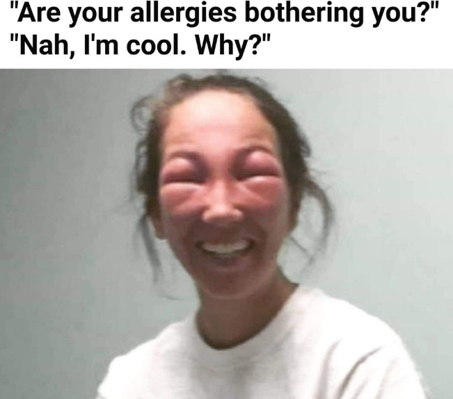 "Are your allergies bothering you?" "Nah, I'm cool. Why?"