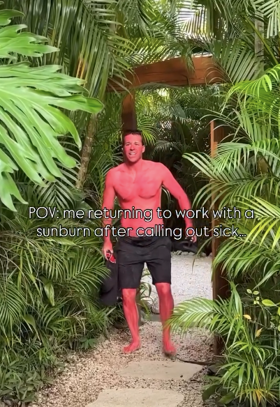 POV: me returning to work with a sunburn after calling out sick...