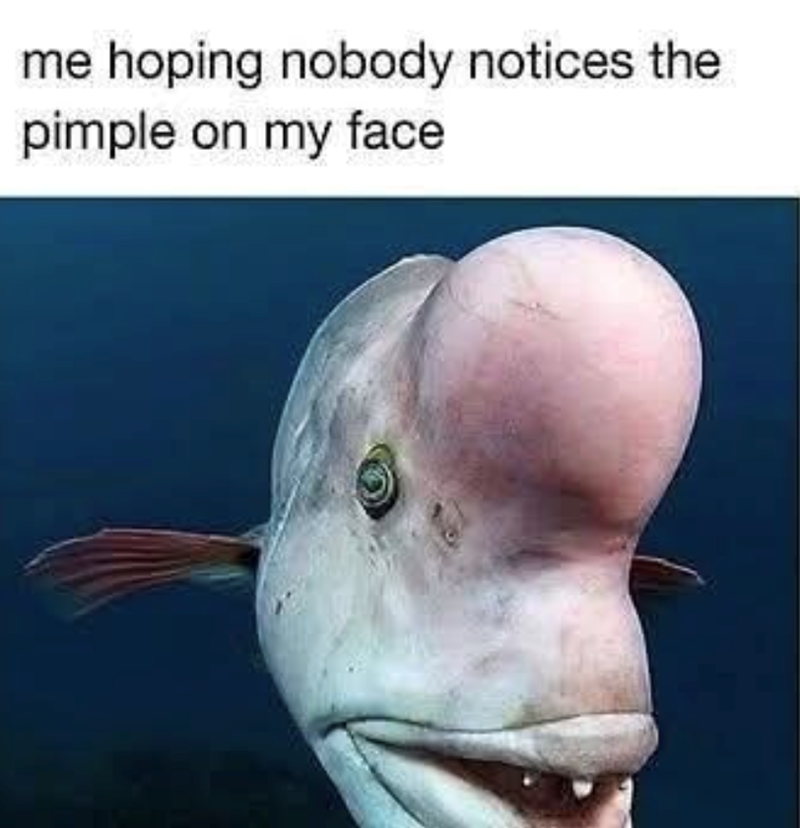 me hoping nobody notices the pimple on my face