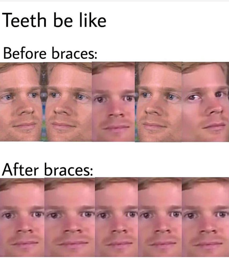 Teeth be like Before braces: After braces:
