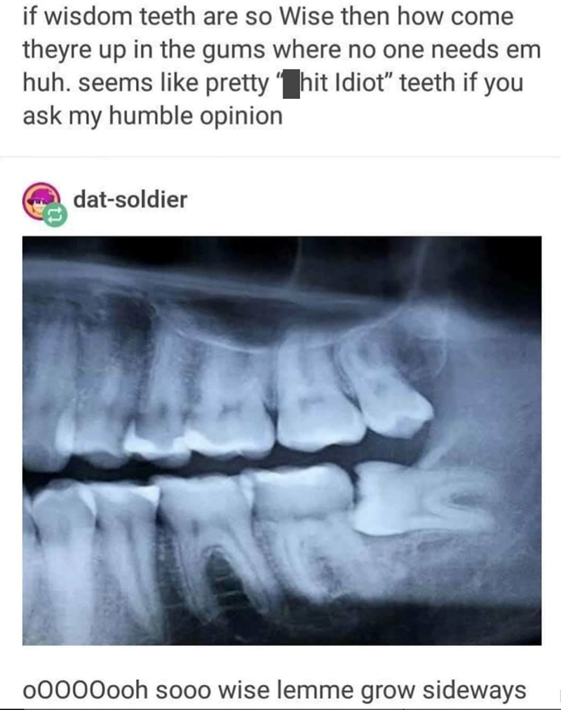 if wisdom teeth are so Wise then how come theyre up in the gums where no one needs em huh. seems like pretty hit Idiot" teeth if you ask my humble opinion dat-soldier 00000ooh sooo wise lemme grow sideways