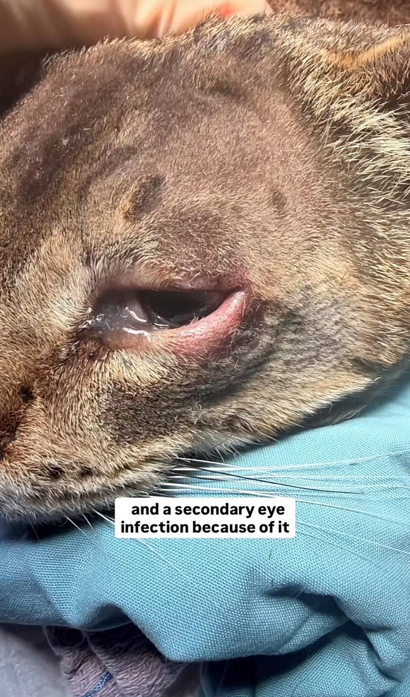 and a secondary eye infection because of it