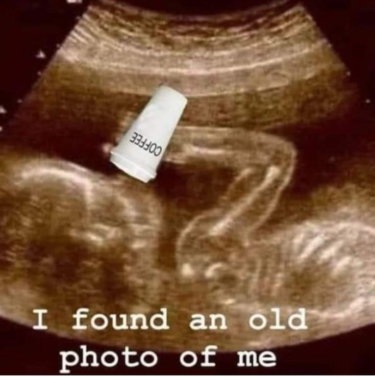 I found an old photo of me