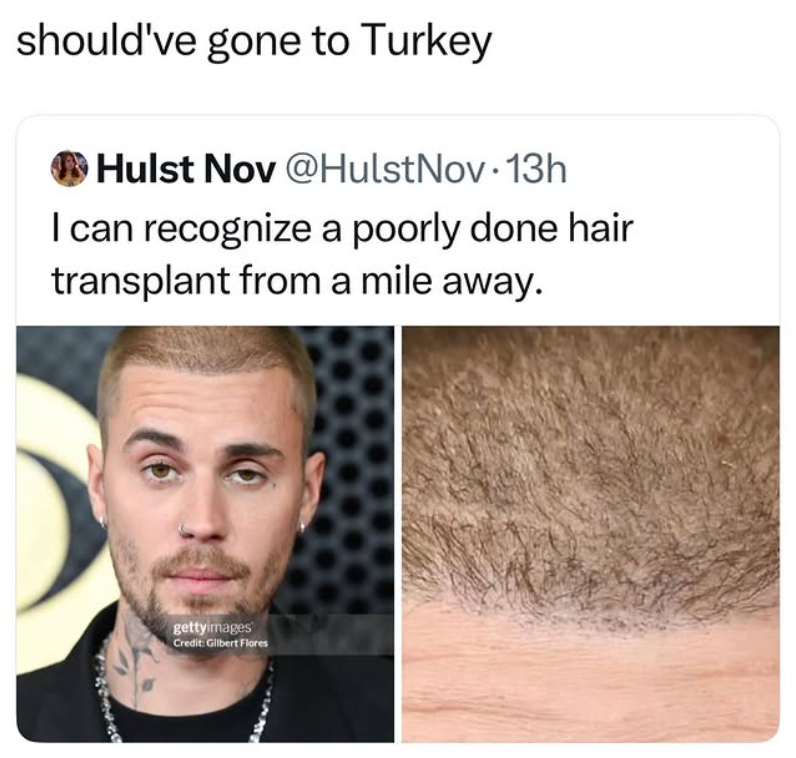 should've gone to Turkey Hulst Nov@HulstNov 13h I can recognize a poorly done hair transplant from a mile away. gettyimages Credit: Gilbert Flores