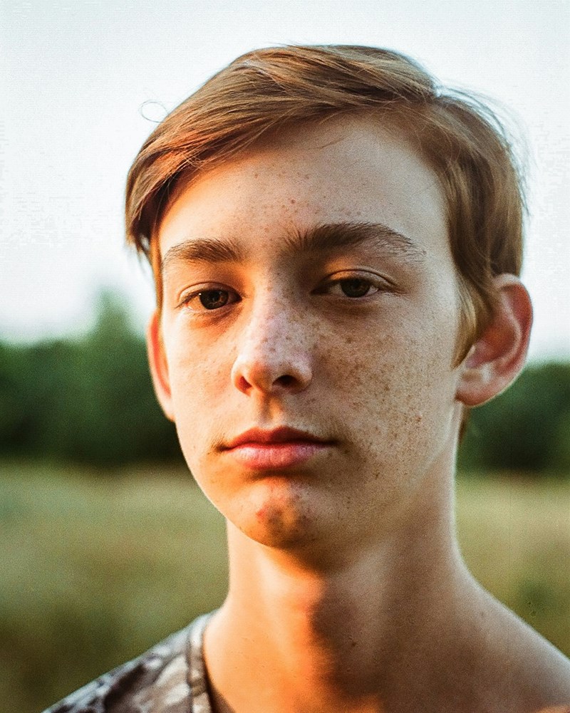 Close-up portrait of a teenage boy outdoors in warm evening sunlight with freckles and a neutral expression.