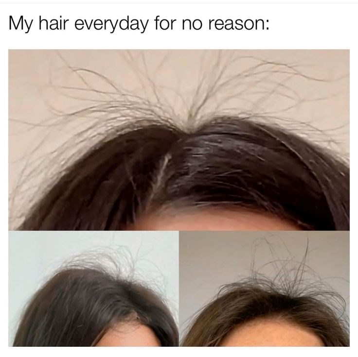 My hair everyday for no reason:
