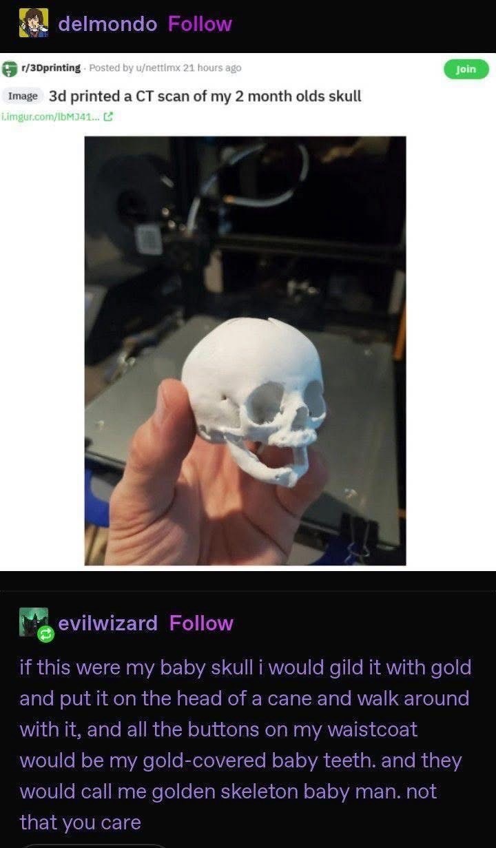 delmondo Follow r/3Dprinting Posted by u/nettimx 21 hours ago Image 3d printed a CT scan of my 2 month olds skull i.imgur.com/lbM341... Join evilwizard Follow if this were my baby skull i would gild it with gold and put it on the head of a cane and walk around with it, and all the buttons on my waistcoat would be my gold-covered baby teeth. and they would call me golden skeleton baby man. not that you care