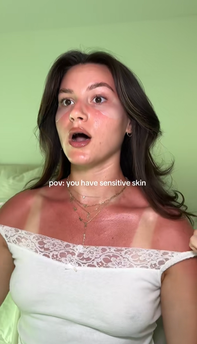 pov: you have sensitive skin