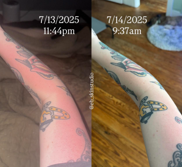 7/13/2025 11:44pm 7/14/2025 9:37am @eb_skinstudio