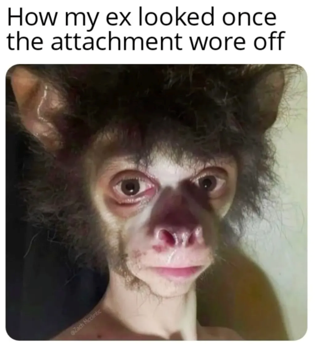 Zach Mcclintic How my ex looked once the attachment wore off