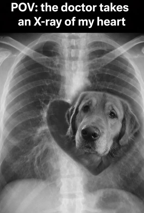 POV: the doctor takes an X-ray of my heart