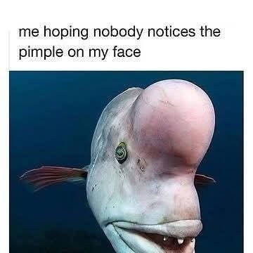 me hoping nobody notices the pimple on my face