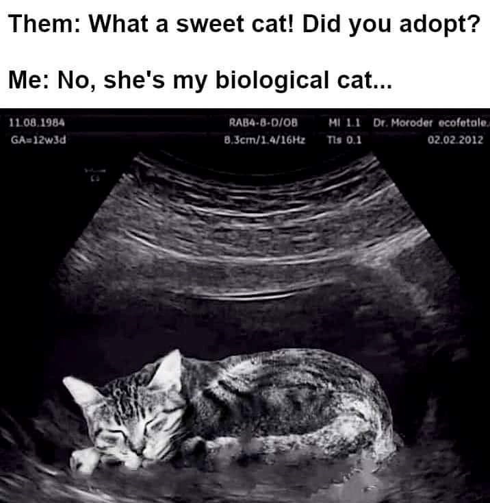 Them: What a sweet cat! Did you adopt? Me: No, she's my biological cat... 11.08.1984 GA=12w3d RAB4-8-D/OB MI 1.1 Dr. Moroder ecofetale. 8.3cm/1.4/16Hz Tis 0.1 02.02.2012