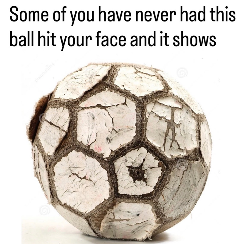 Some of you have never had this ball hit your face and it shows dreamstime