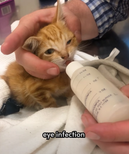 eye infection OONFUL 1502 11 OZ √207 ZO POONFUL NY 11788 OZ POLY NURSER