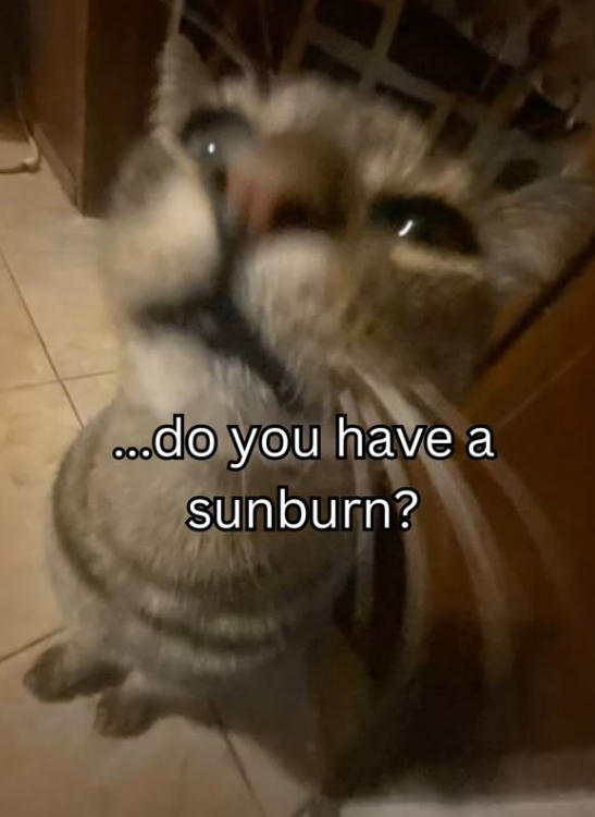 ...do you have a sunburn?