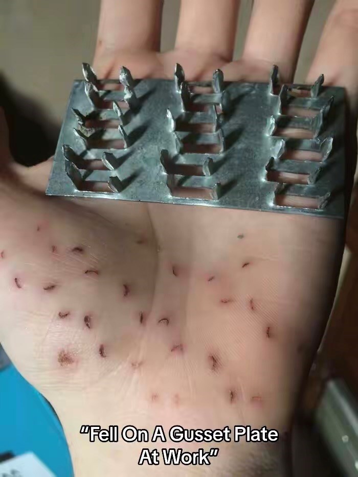 "Fell On A Gusset Plate At Work"