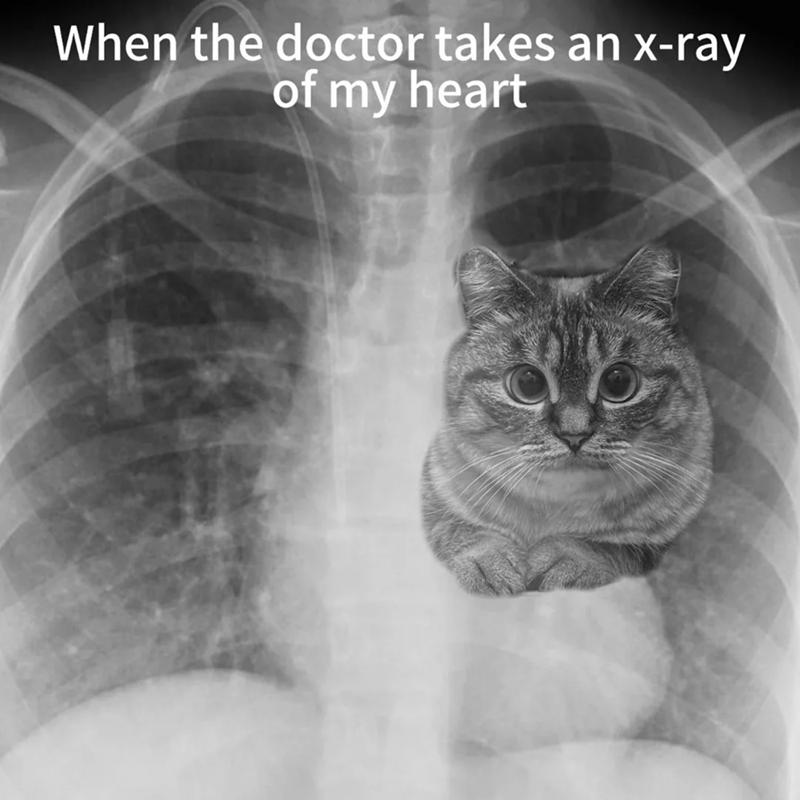 When the doctor takes an x-ray of my heart