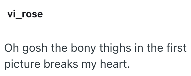 vi_rose Oh gosh the bony thighs in the first picture breaks my heart.