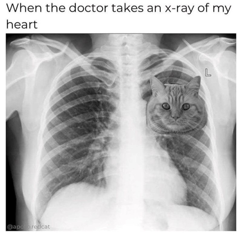 When the doctor takes an x-ray of my heart @apoo.redcat L