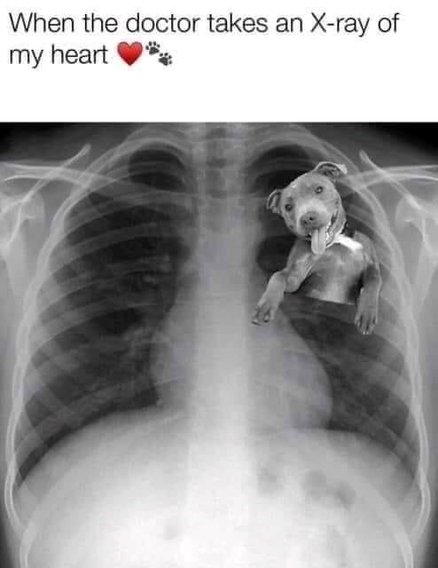 When the doctor takes an X-ray of my heart