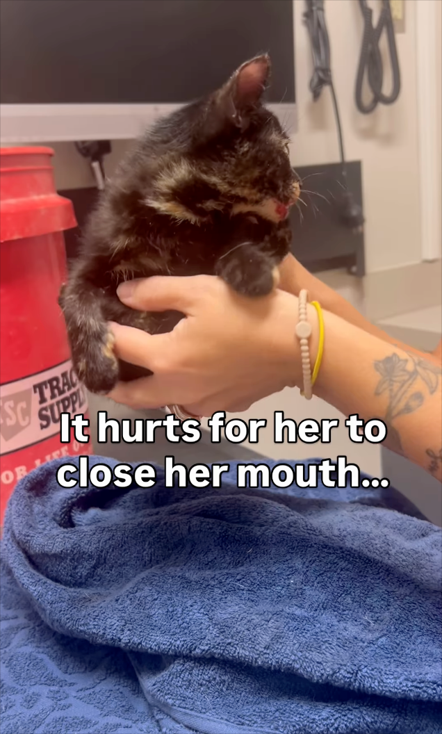SC TRAC SUPP OR HE It hurts for her to close her mouth...