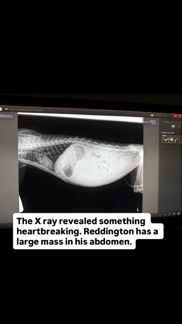 Thorax-Wholebody Left Lat 8/22/26 L The X ray revealed something heartbreaking. Reddington has a large mass in his abdomen. 8/23/26 10:52AM