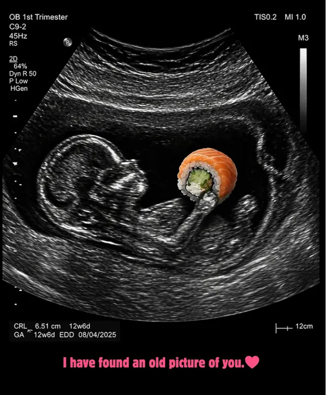 OB 1st Trimester C9-2 45Hz RS 2D 64% Dyn R 50 P Low HGen TISO.2 MI 1.0 M3 CRL 6.51 cm 12w6d GA 12w6d EDD 08/04/2025 I have found an old picture of you. 12cm