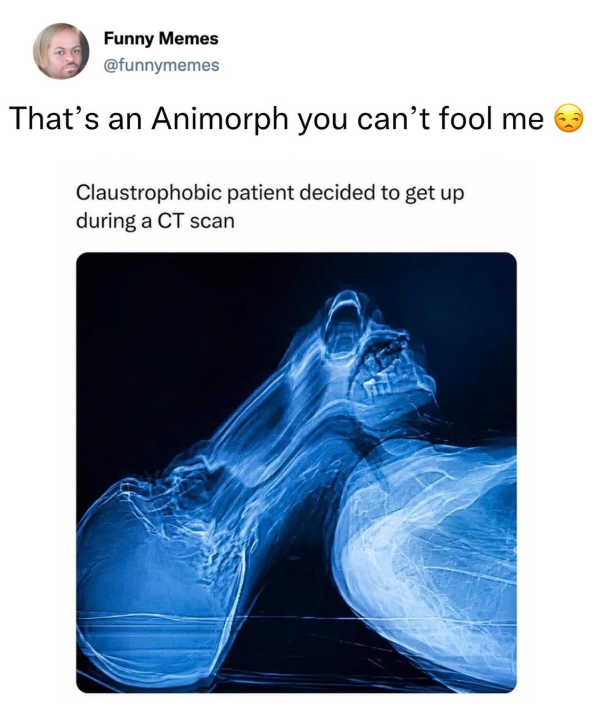 Funny Memes @funnymemes That's an Animorph you can't fool me Claustrophobic patient decided to get up during a CT scan