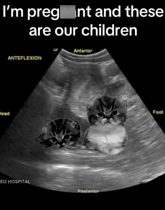 I'm preg Int and these are our children Head ANTEFLEXION Anterior EO HOSPITAL Posterior Foot