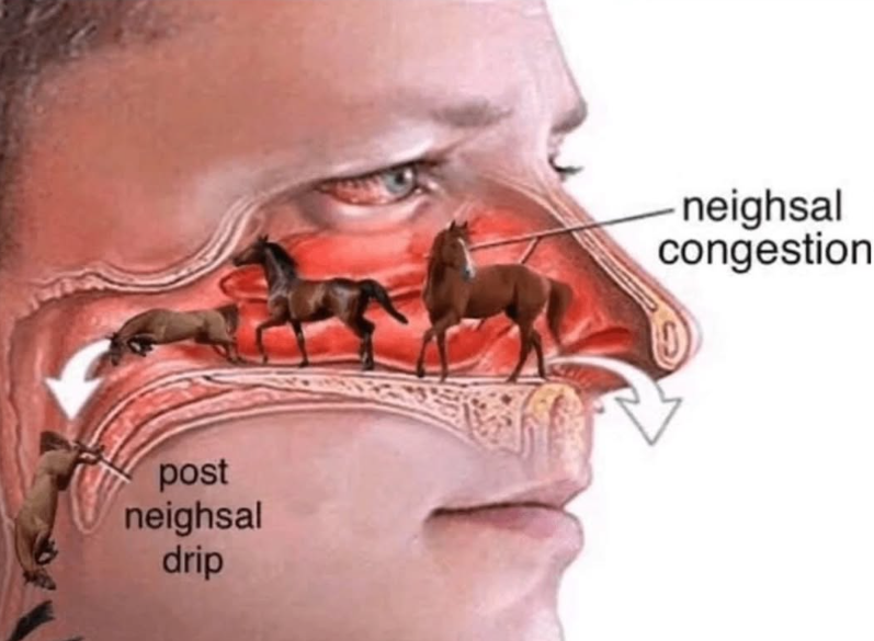 post neighsal drip -neighsal congestion