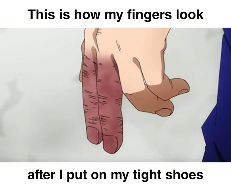 This is how my fingers look after I put on my tight shoes