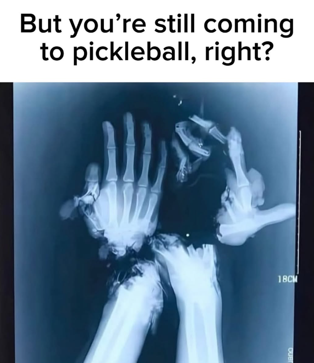 But you're still coming to pickleball, right? 18CM Cuer