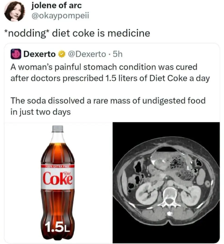 jolene of arc @okaypompeii *nodding* diet coke is medicine Dexerto @Dexerto. 5h A woman's painful stomach condition was cured after doctors prescribed 1.5 liters of Diet Coke a day The soda dissolved a rare mass of undigested food in just two days *20% EXTRA FREE Coke 1.5L