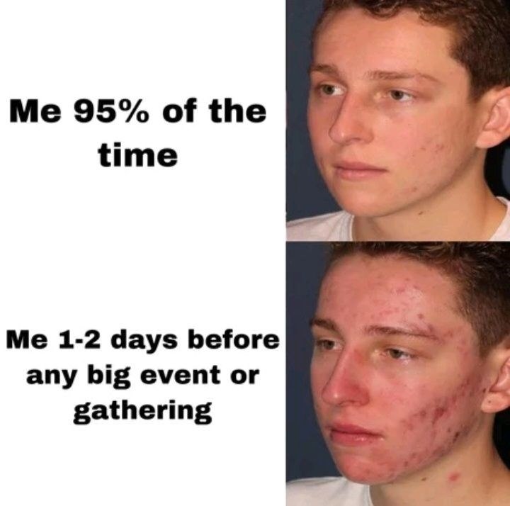 Me 95% of the time Me 1-2 days before any big event or gathering