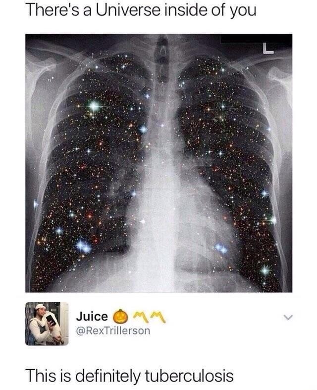There's a Universe inside of you Juice @RexTrillerson This is definitely tuberculosis