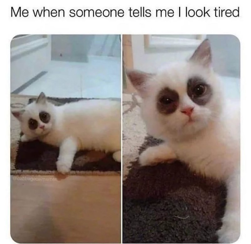 Me when someone tells me I look tired. Yeabbagecamus