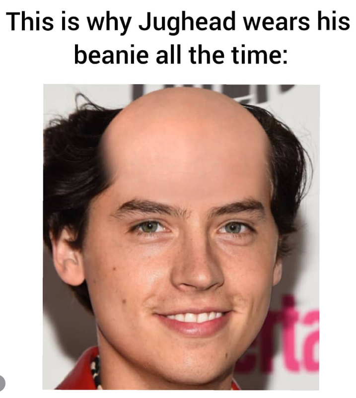 This is why Jughead wears his beanie all the time: