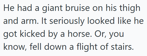 He had a giant bruise on his thigh and arm. It seriously looked like he got kicked by a horse. Or, you know, fell down a flight of stairs.