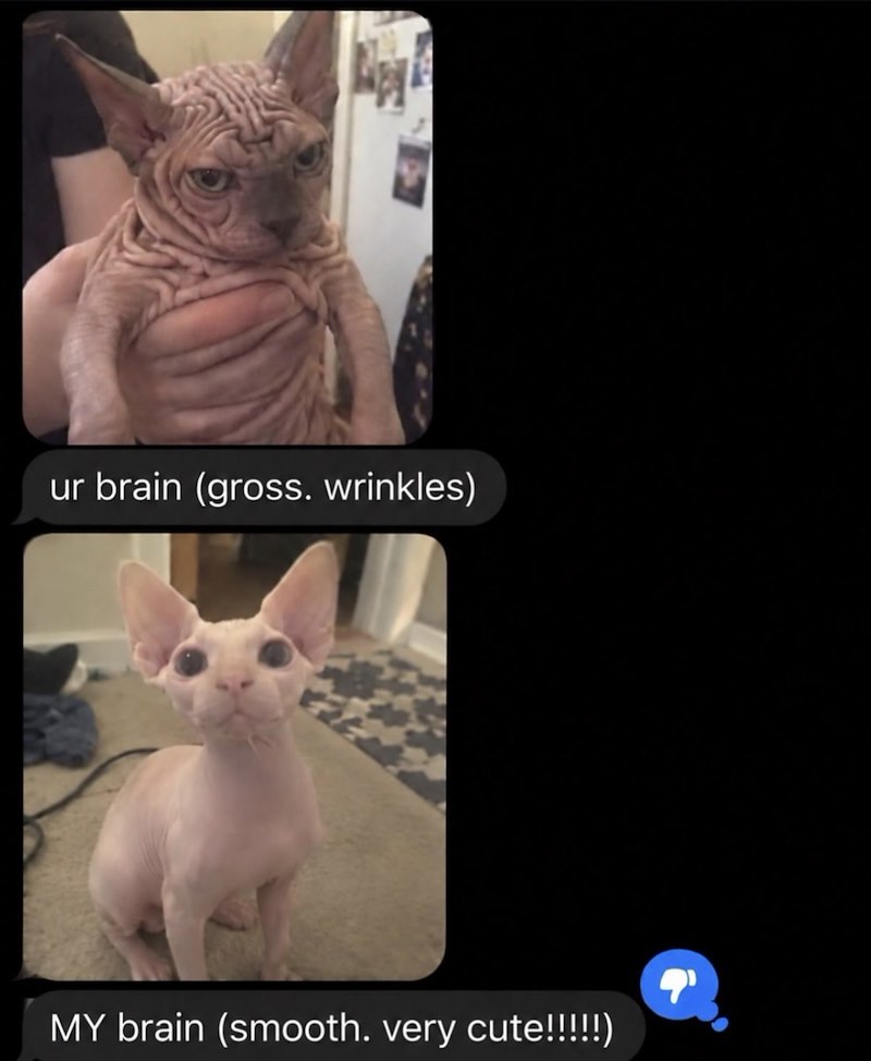 ur brain (gross. wrinkles) MY brain (smooth. very cute!!!!!)