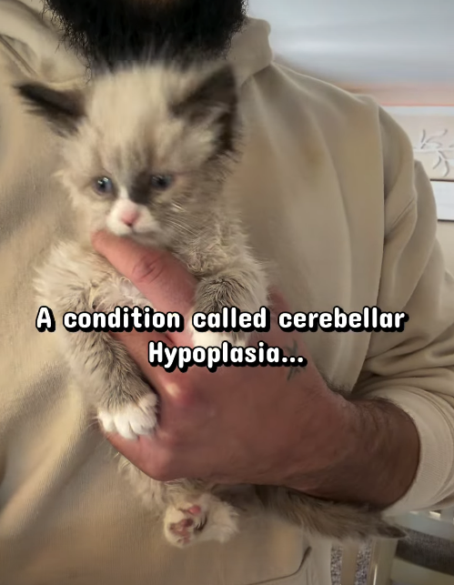 A condition called cerebellar Hypoplasia...
