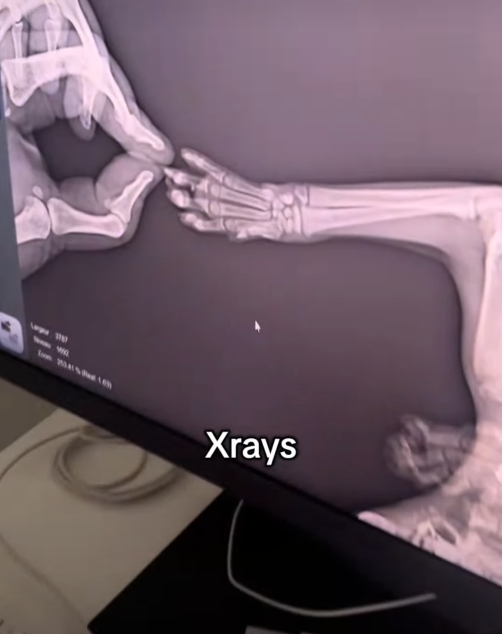 20141 Xrays