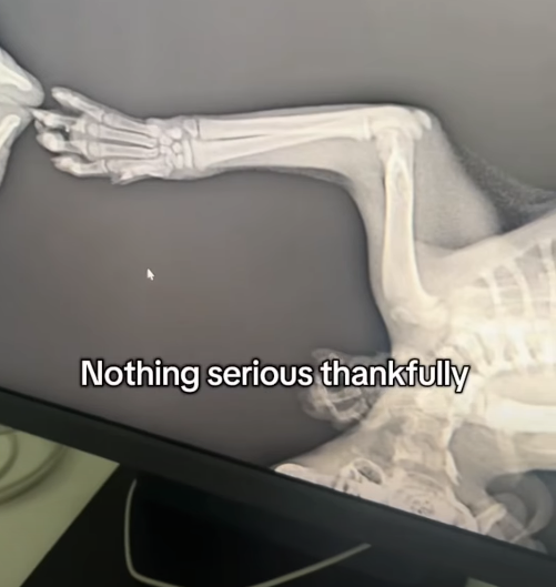 Nothing serious thankfully