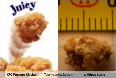 KFC Popcorn Chicken Totally Looks Like a kidney stone