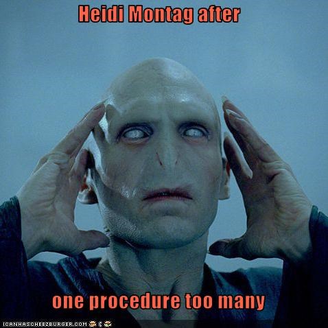 Heidi Montag after  one procedure too many